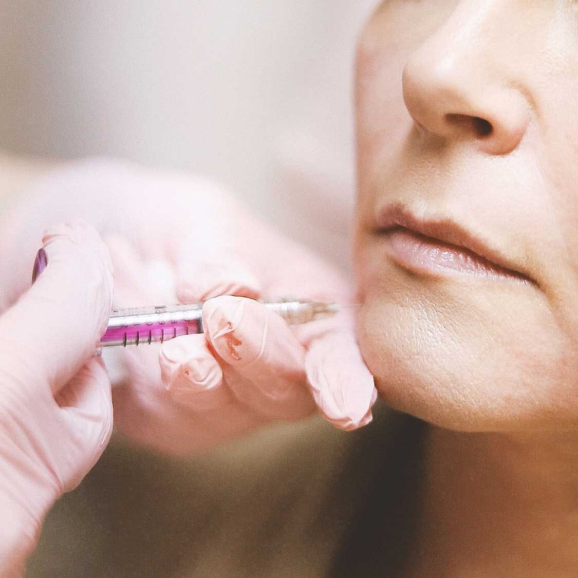 dermaporium-aesthetic-treatments-dermal-fillers