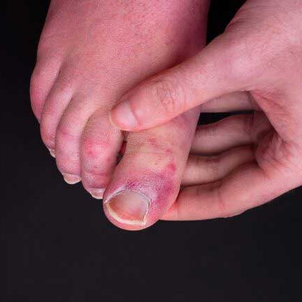 dermaporium-medical-dermatology-fungal-bacterial-skin-infection