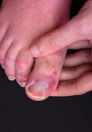 dermaporium-medical-dermatology-fungal-bacterial-skin-infection