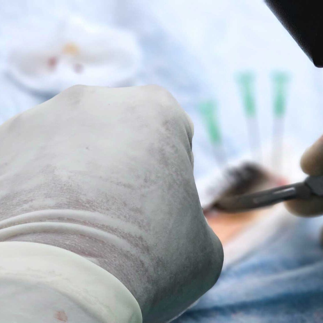 dermaporium-procedures-excision-of-skin-lesions
