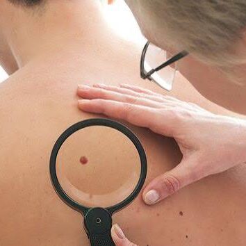 dermaporium-skin-cancer-mole-mapping-dermoscopy